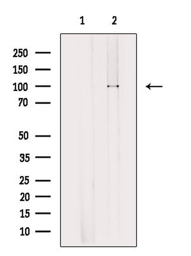 OTUD7B Antibody in Western Blot (WB)