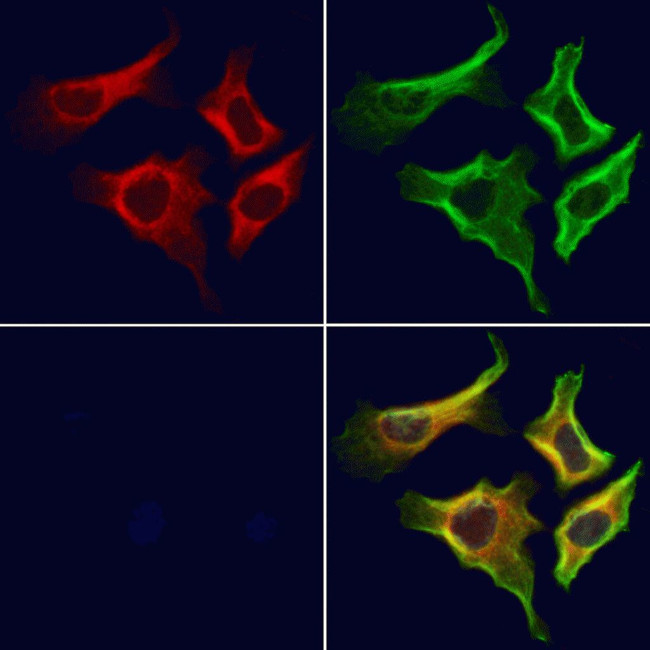 P4HA1 Antibody in Immunocytochemistry (ICC/IF)