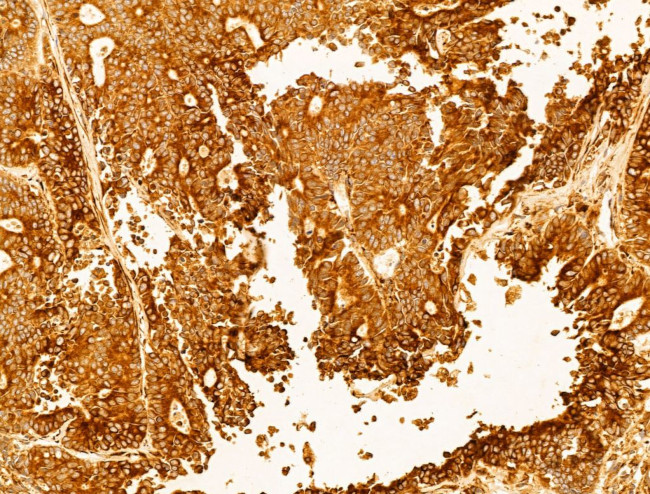 P4HA1 Antibody in Immunohistochemistry (Paraffin) (IHC (P))