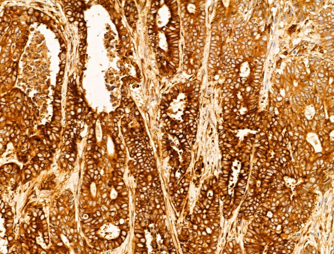 P4HA1 Antibody in Immunohistochemistry (Paraffin) (IHC (P))