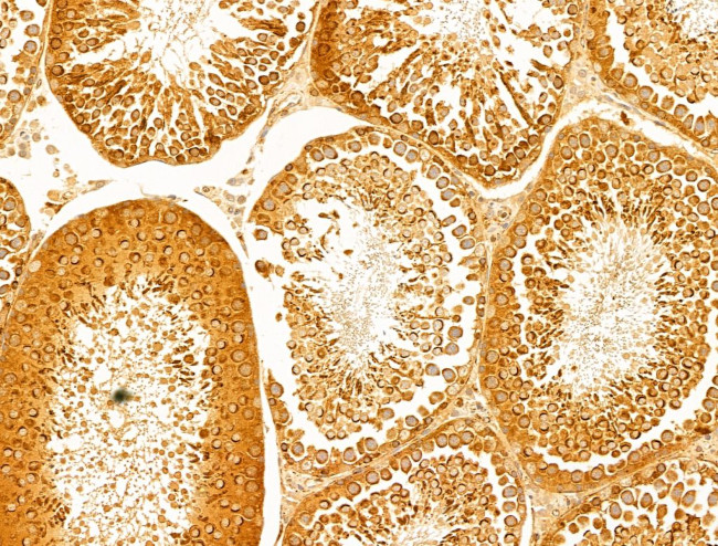 P4HA1 Antibody in Immunohistochemistry (Paraffin) (IHC (P))