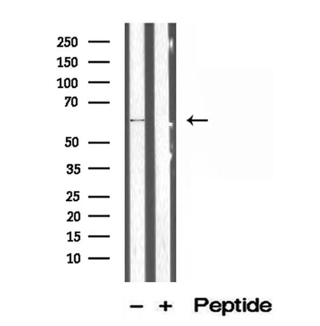 P4HA1 Antibody in Western Blot (WB)