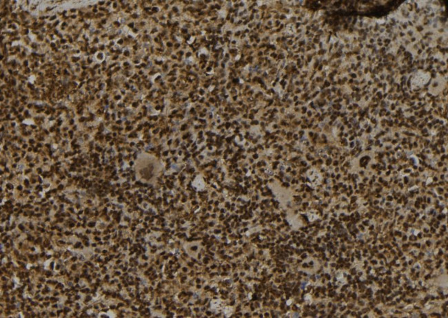 SBP2 Antibody in Immunohistochemistry (Paraffin) (IHC (P))