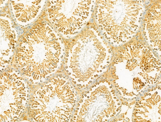 SBP2 Antibody in Immunohistochemistry (Paraffin) (IHC (P))