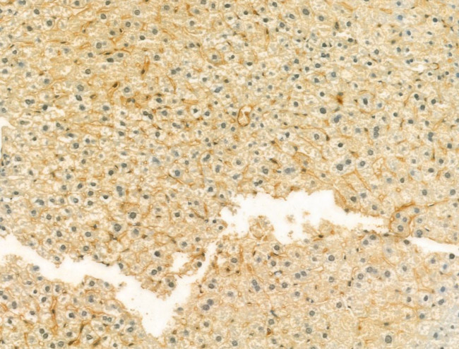 UQCRFS1 Antibody in Immunohistochemistry (Paraffin) (IHC (P))