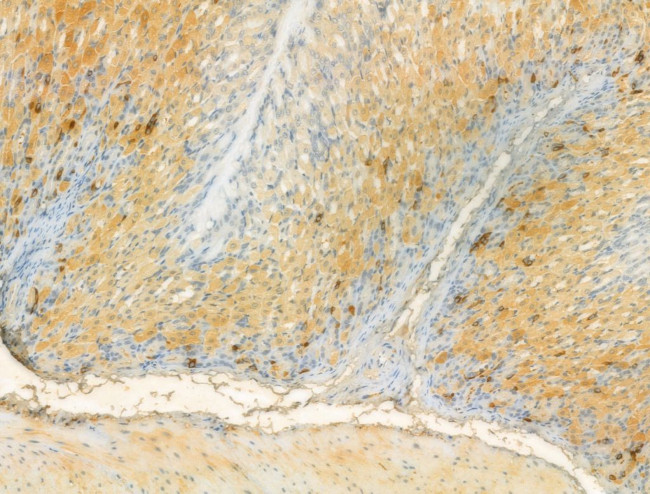 UQCRFS1 Antibody in Immunohistochemistry (Paraffin) (IHC (P))