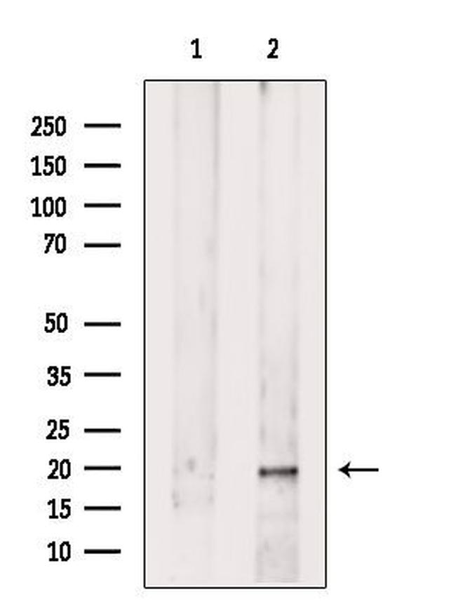 UQCRFS1 Antibody in Western Blot (WB)