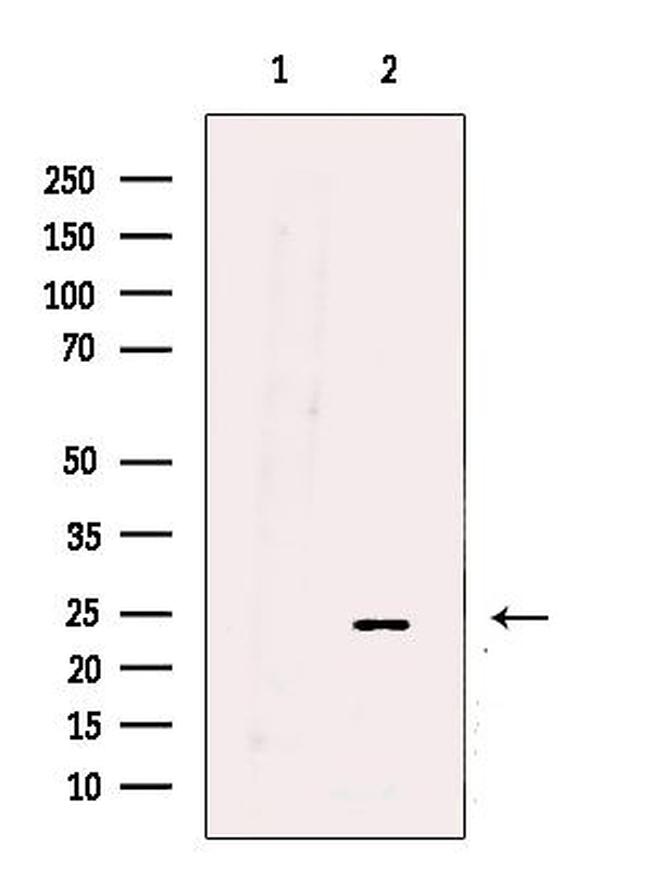 UQCRFS1 Antibody in Western Blot (WB)