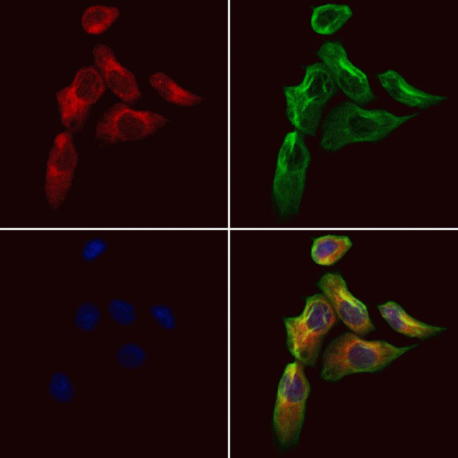 COQ7 Antibody in Immunocytochemistry (ICC/IF)