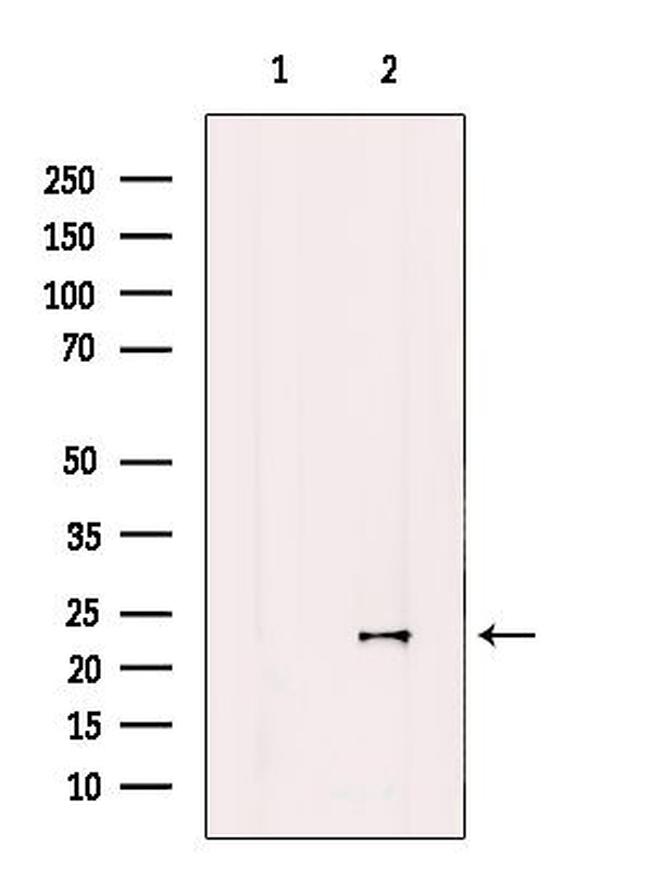 COQ7 Antibody in Western Blot (WB)