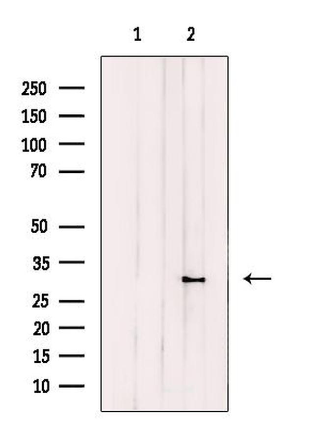 CPSF4 Antibody in Western Blot (WB)