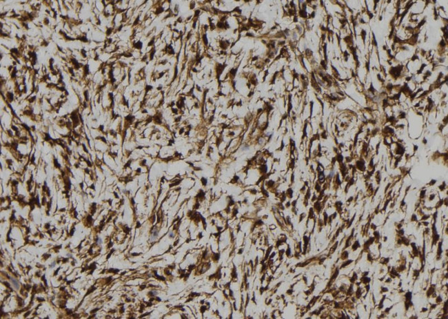 CREB3L1 Antibody in Immunohistochemistry (Paraffin) (IHC (P))