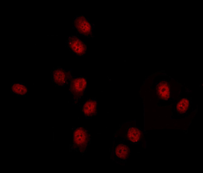 DYX1C1 Antibody in Immunocytochemistry (ICC/IF)