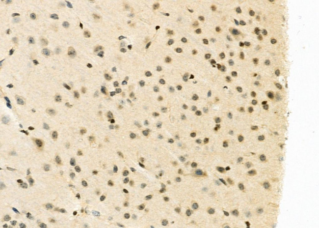 FAM96B Antibody in Immunohistochemistry (Paraffin) (IHC (P))