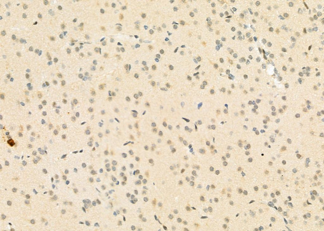 FAM96B Antibody in Immunohistochemistry (Paraffin) (IHC (P))