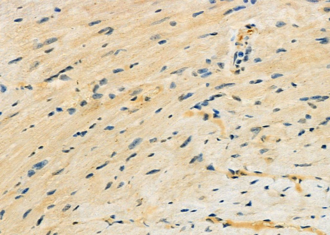 FECH Antibody in Immunohistochemistry (Paraffin) (IHC (P))