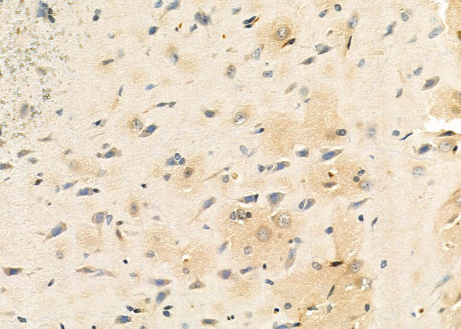 FECH Antibody in Immunohistochemistry (Paraffin) (IHC (P))