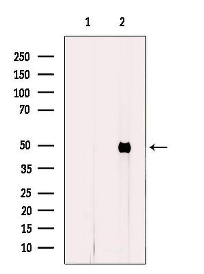 FECH Antibody in Western Blot (WB)