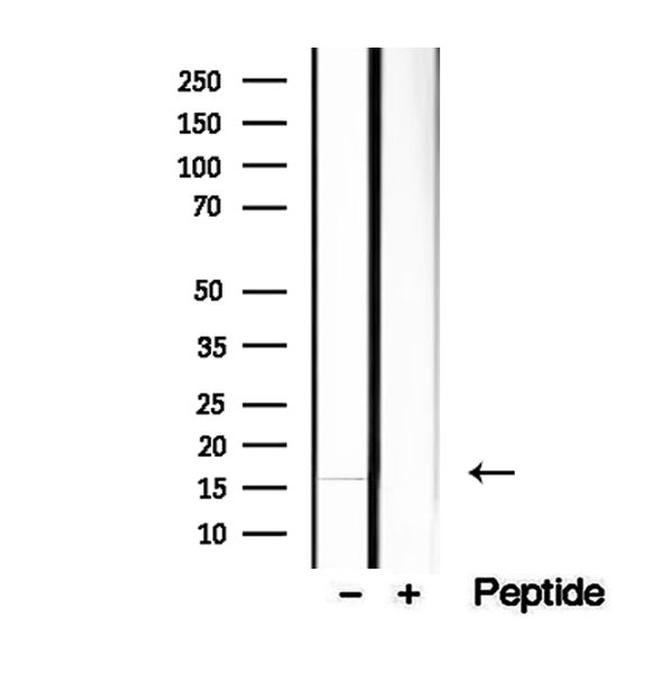 HBE1 Antibody in Western Blot (WB)