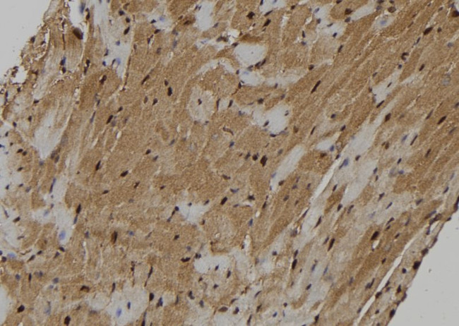 KIF18A Antibody in Immunohistochemistry (Paraffin) (IHC (P))