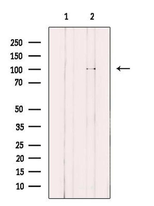 KIF18A Antibody in Western Blot (WB)