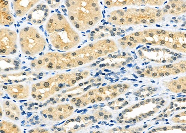 MAD2L2 Antibody in Immunohistochemistry (Paraffin) (IHC (P))