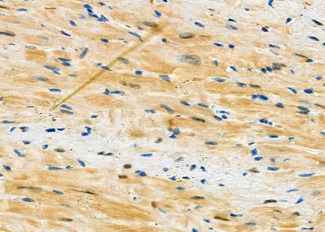 Mast Cell Chymase Antibody in Immunohistochemistry (Paraffin) (IHC (P))