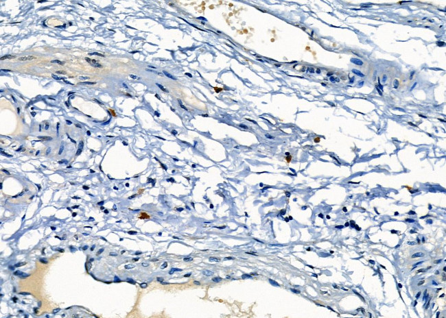 Mast Cell Chymase Antibody in Immunohistochemistry (Paraffin) (IHC (P))