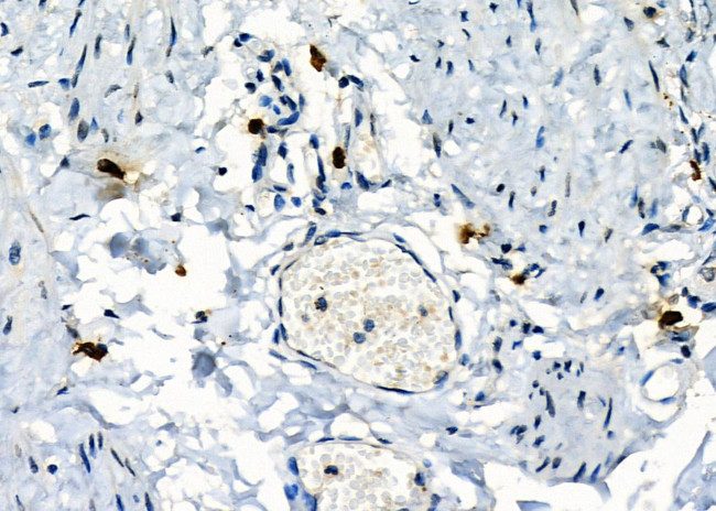 Mast Cell Chymase Antibody in Immunohistochemistry (Paraffin) (IHC (P))