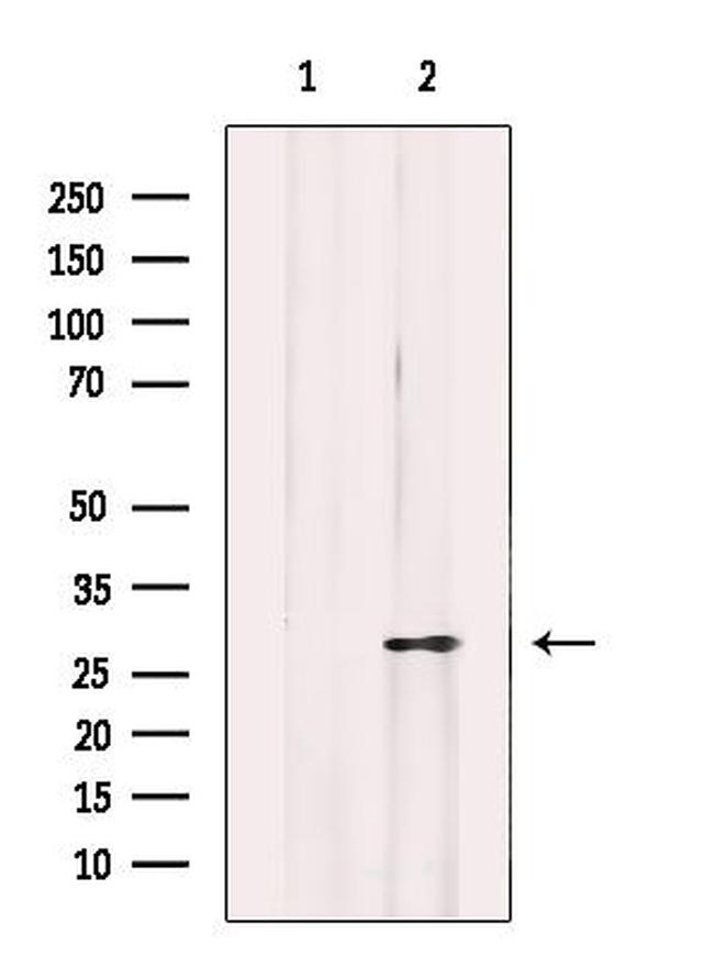 Mast Cell Chymase Antibody in Western Blot (WB)