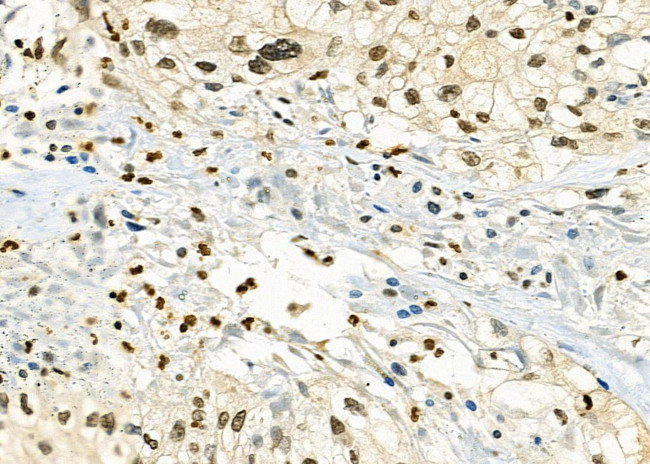 SSNA1 Antibody in Immunohistochemistry (Paraffin) (IHC (P))