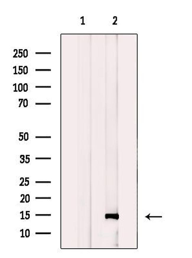 SSNA1 Antibody in Western Blot (WB)