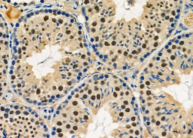 NUFIP1 Antibody in Immunohistochemistry (Paraffin) (IHC (P))