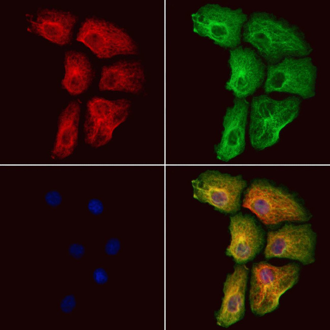 RASGRP3 Antibody in Immunocytochemistry (ICC/IF)