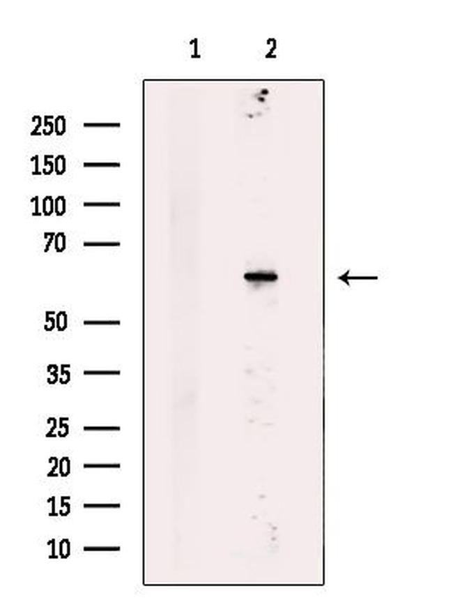 SACM1L Antibody in Western Blot (WB)