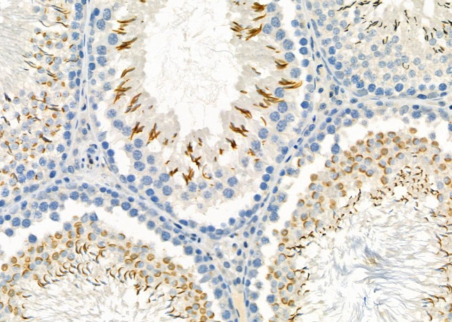 STC2 Antibody in Immunohistochemistry (Paraffin) (IHC (P))