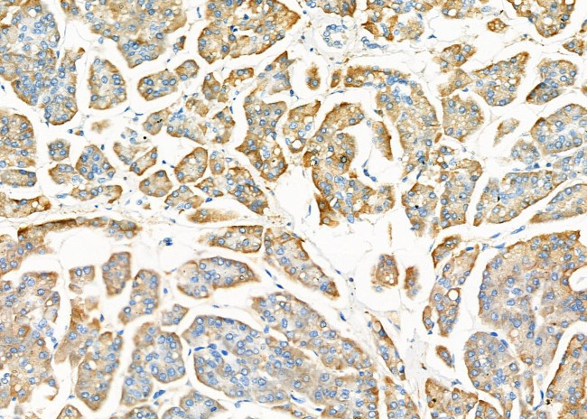 STT3B Antibody in Immunohistochemistry (Paraffin) (IHC (P))