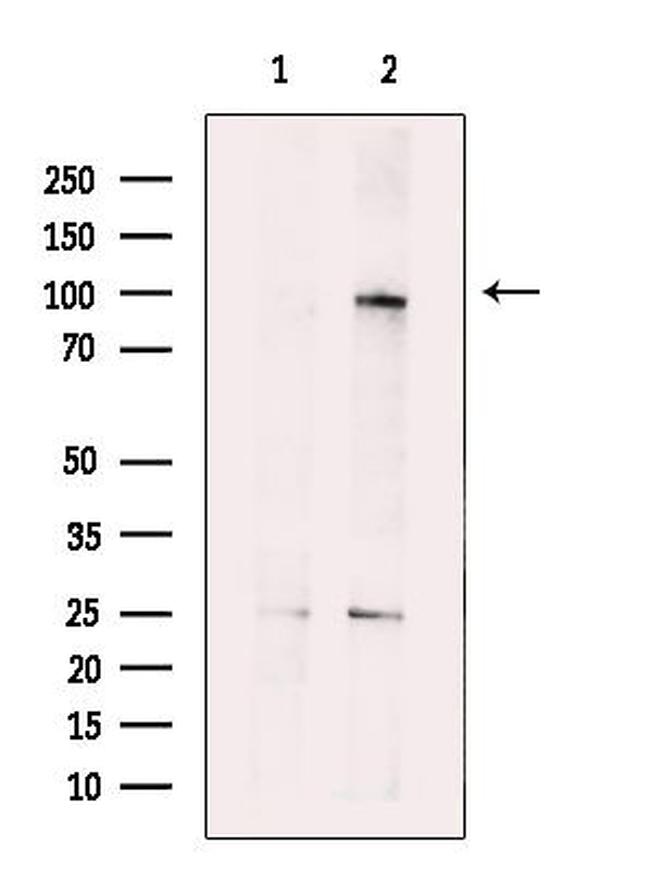 STT3B Antibody in Western Blot (WB)