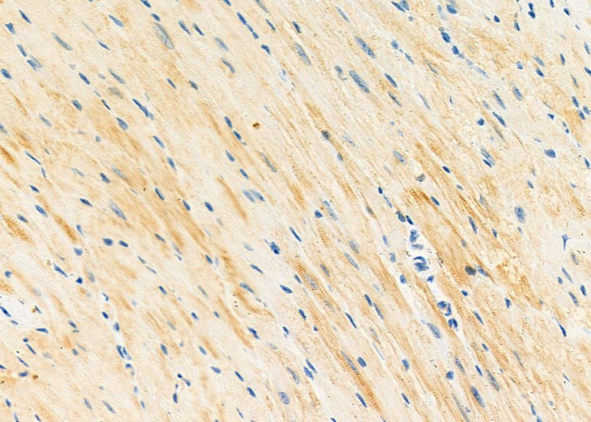 STX16 Antibody in Immunohistochemistry (Paraffin) (IHC (P))