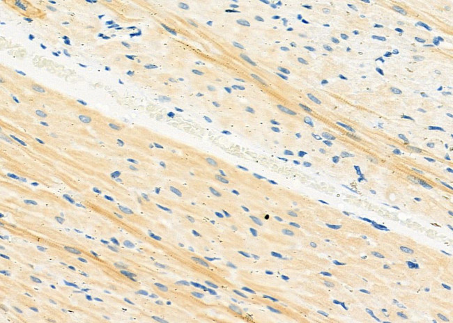 STX16 Antibody in Immunohistochemistry (Paraffin) (IHC (P))