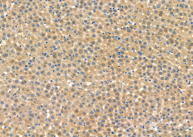 STX16 Antibody in Immunohistochemistry (Paraffin) (IHC (P))