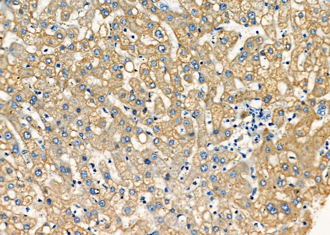 STX16 Antibody in Immunohistochemistry (Paraffin) (IHC (P))