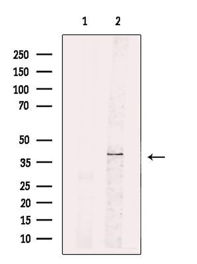 STX16 Antibody in Western Blot (WB)