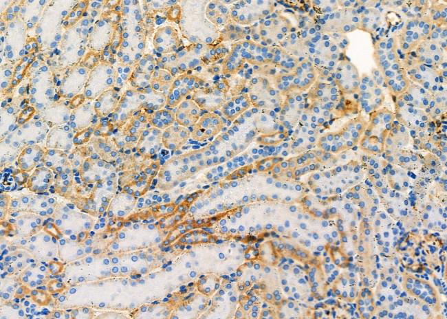 UQCRC2 Antibody in Immunohistochemistry (Paraffin) (IHC (P))