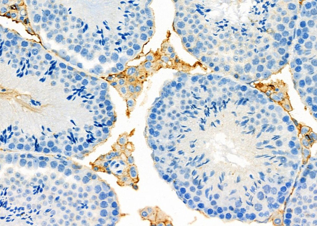 UQCRC2 Antibody in Immunohistochemistry (Paraffin) (IHC (P))