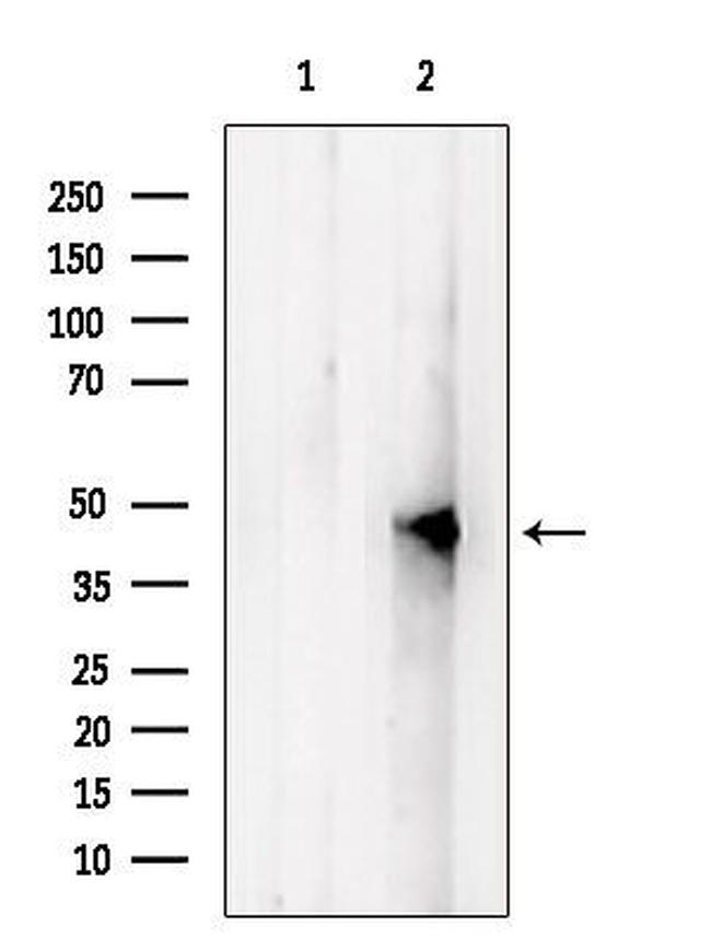 UQCRC2 Antibody in Western Blot (WB)