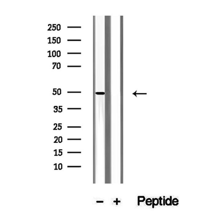 UQCRC2 Antibody in Western Blot (WB)