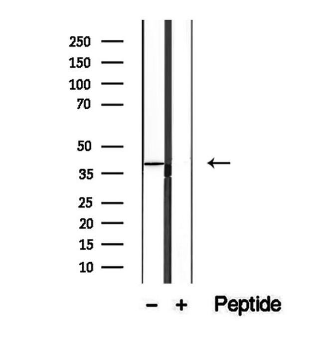 SLC22A12 Antibody in Western Blot (WB)