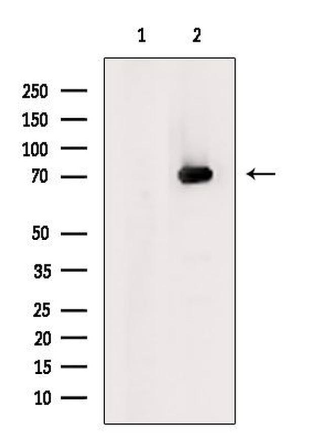 SLC22A12 Antibody in Western Blot (WB)