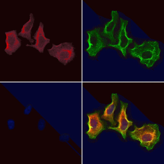 WBP2NL Antibody in Immunocytochemistry (ICC/IF)